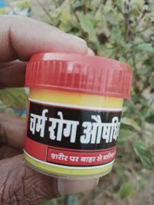 Magical Antifungal Cream | तेष्की चर्म रोग औषधि | Teshki Fungal Infection Ointment